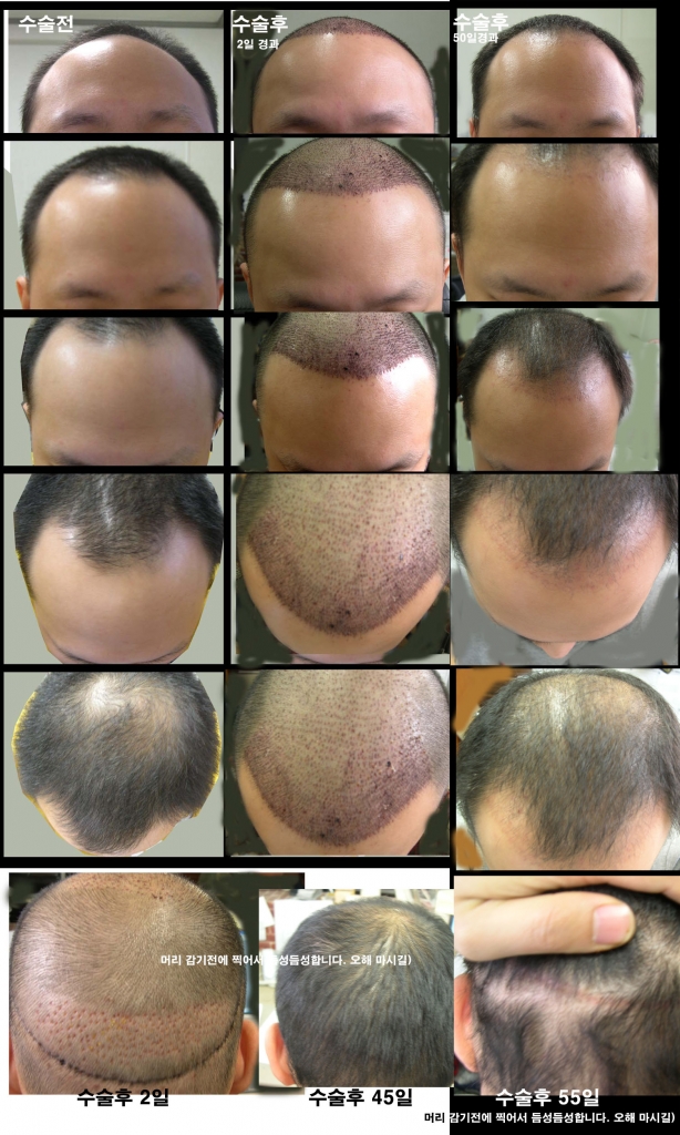 55일재 경과보고.jpg