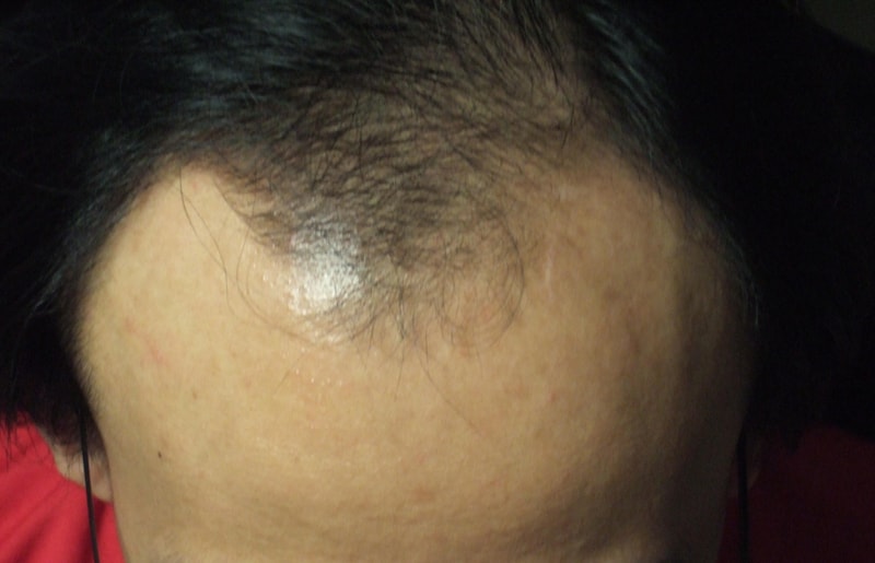 사본 - Front4.jpg