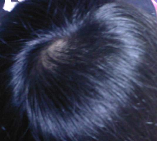 정수리.bmp