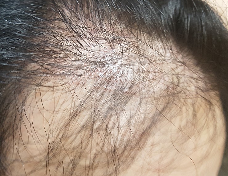 20180508_213221.jpg