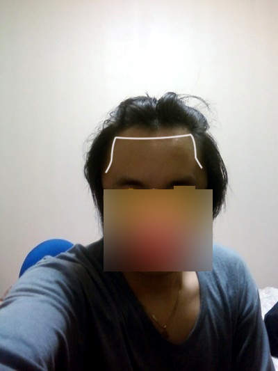 hairline.jpg