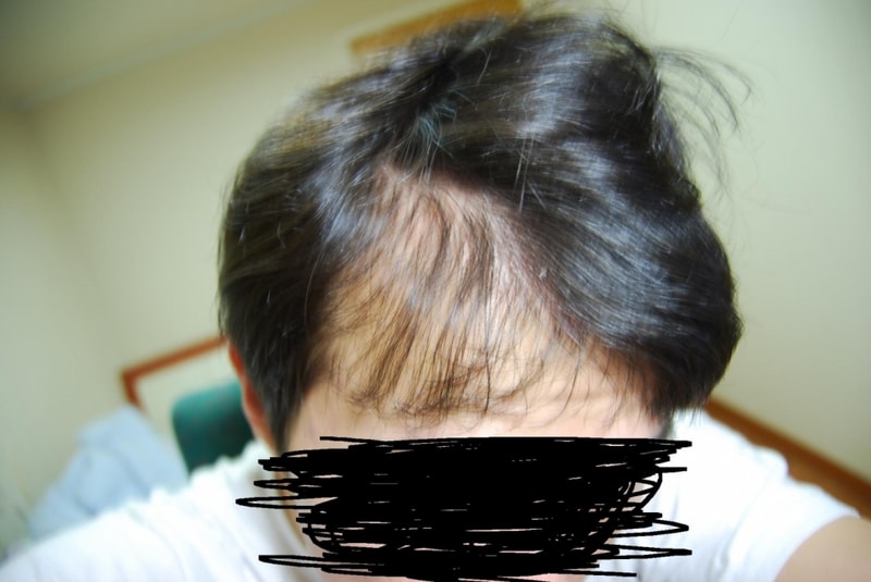 왼쪽.JPG