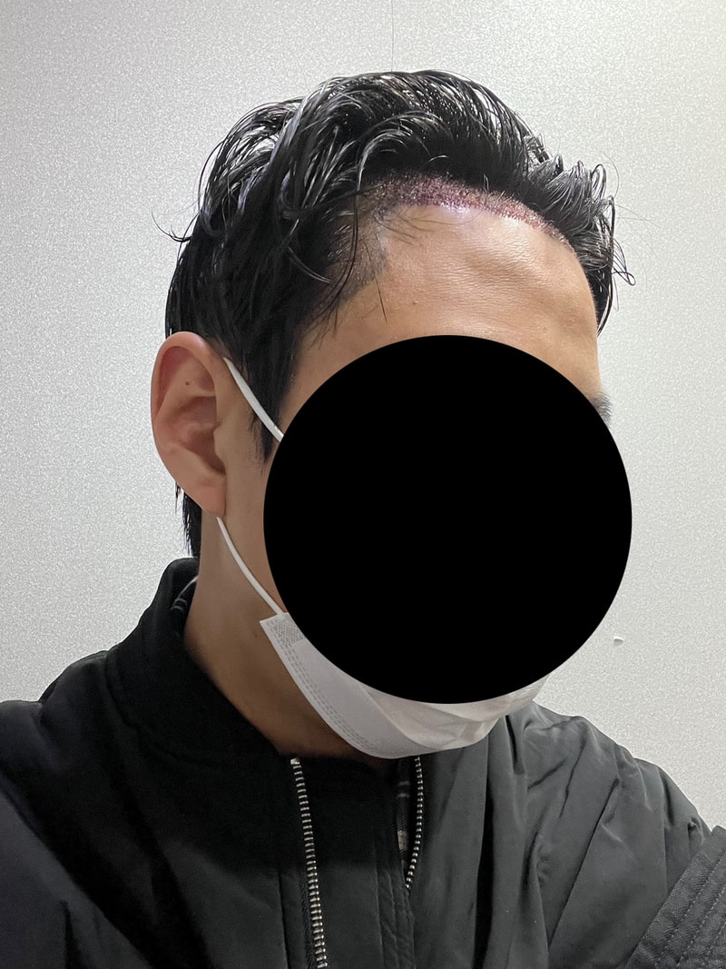 당일 3.jpg