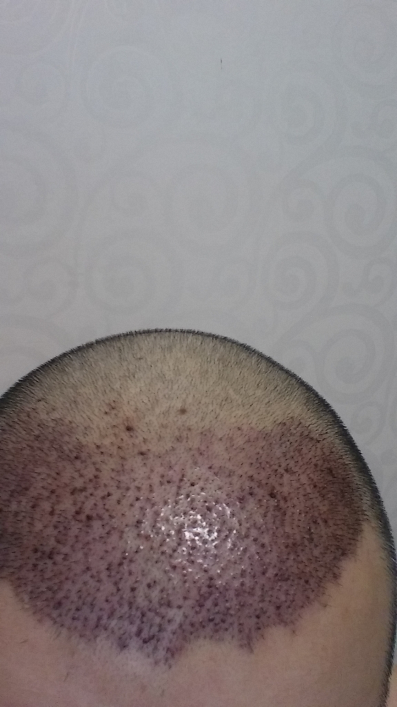 20160617_200421.jpg