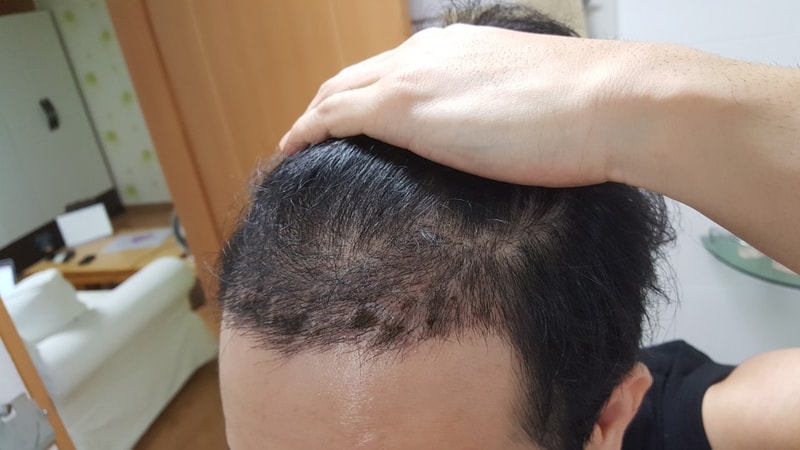 17일차 1.jpg