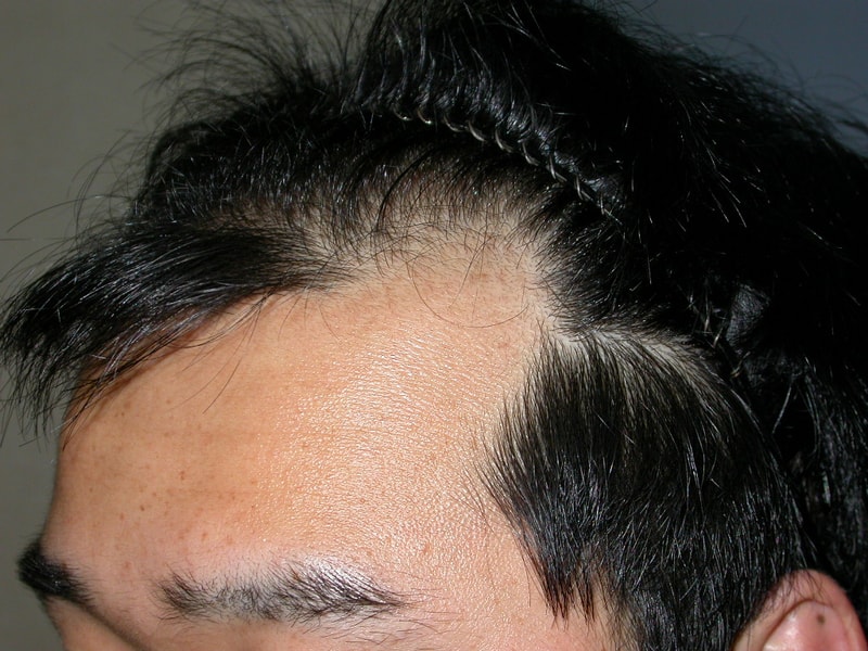 _탈모상담12.JPG