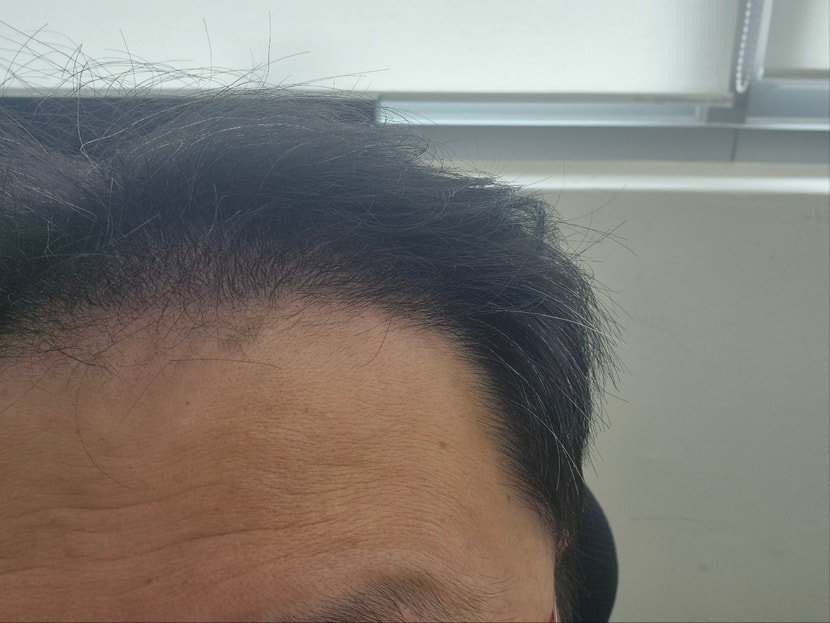 현재