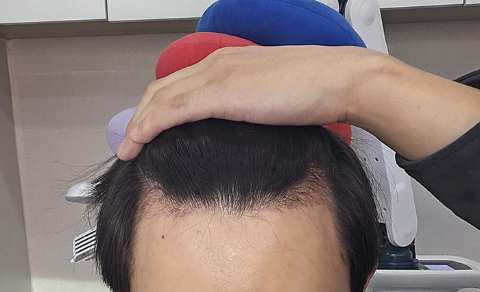 4. 1개월 정면.jpg