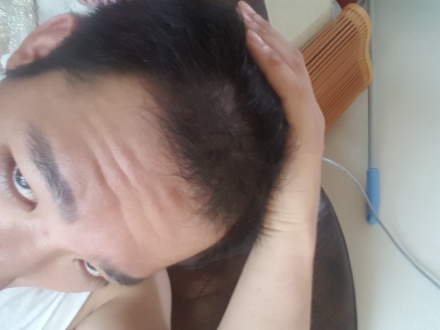 20160710_104645.jpg