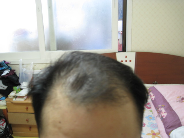 정면.jpg