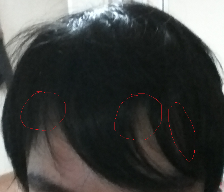 004.png