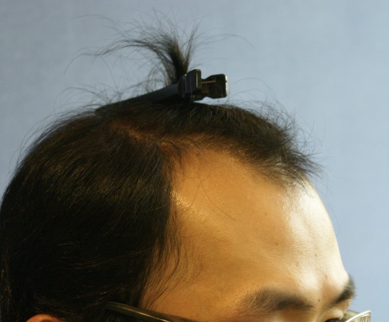 우측면.jpg