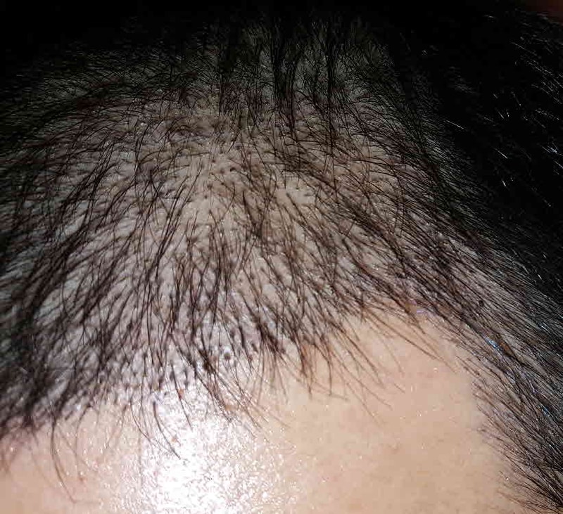 2015920.jpg