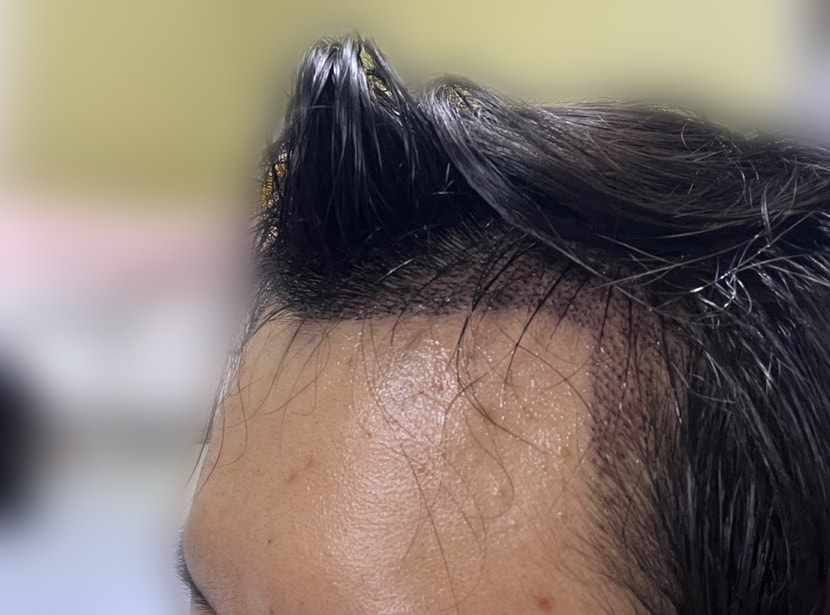 1일차 오른쪽