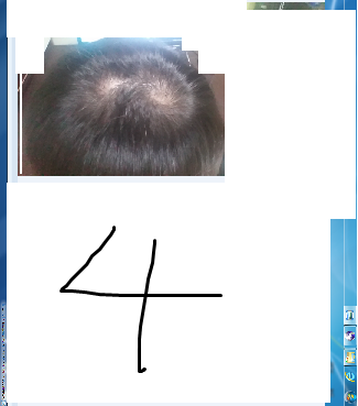 7-14.png