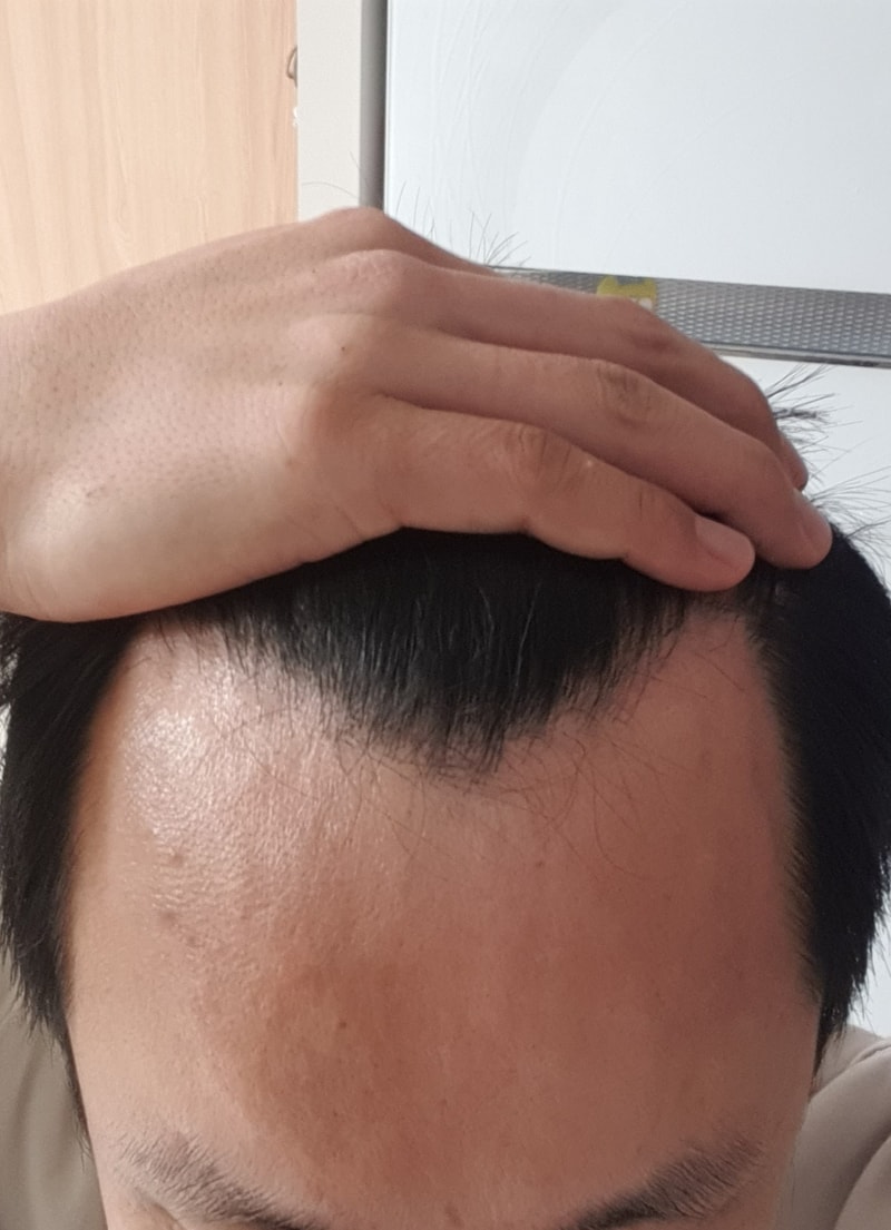 20230203_머리앞면.jpg