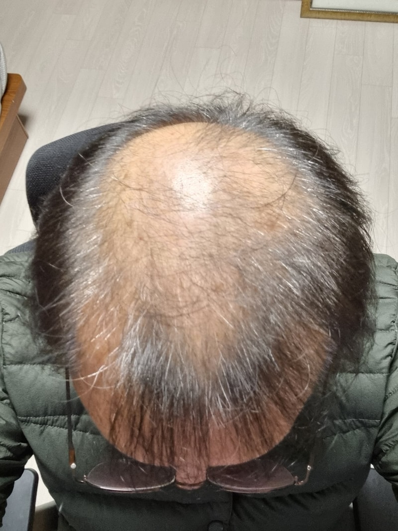 KakaoTalk_20220315_224232595_02.jpg