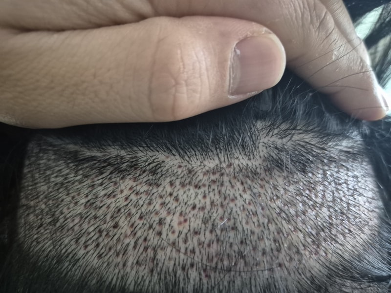 1000029155.jpg