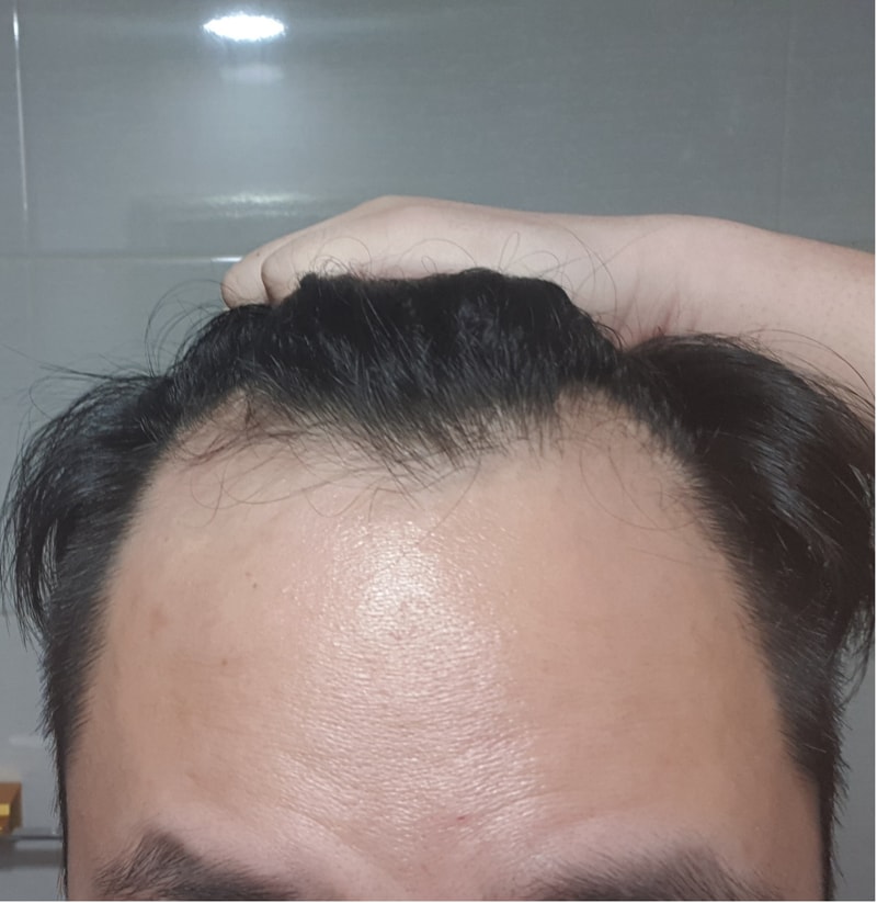 정면2.jpg