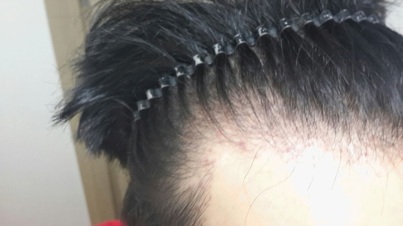 포맷변환_20150704_233354.gif