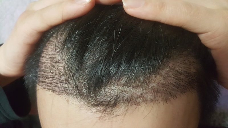 20180410_203014.jpg