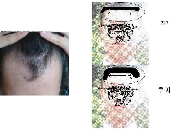 이마2.JPG
