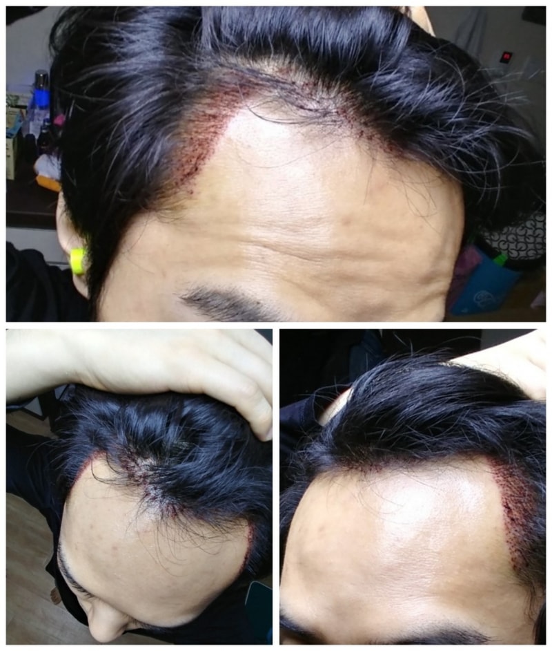 170121_034507_COLLAGE-1.jpg