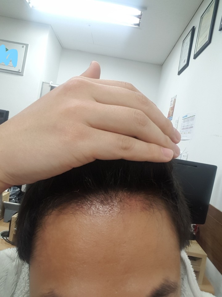 3달.jpg