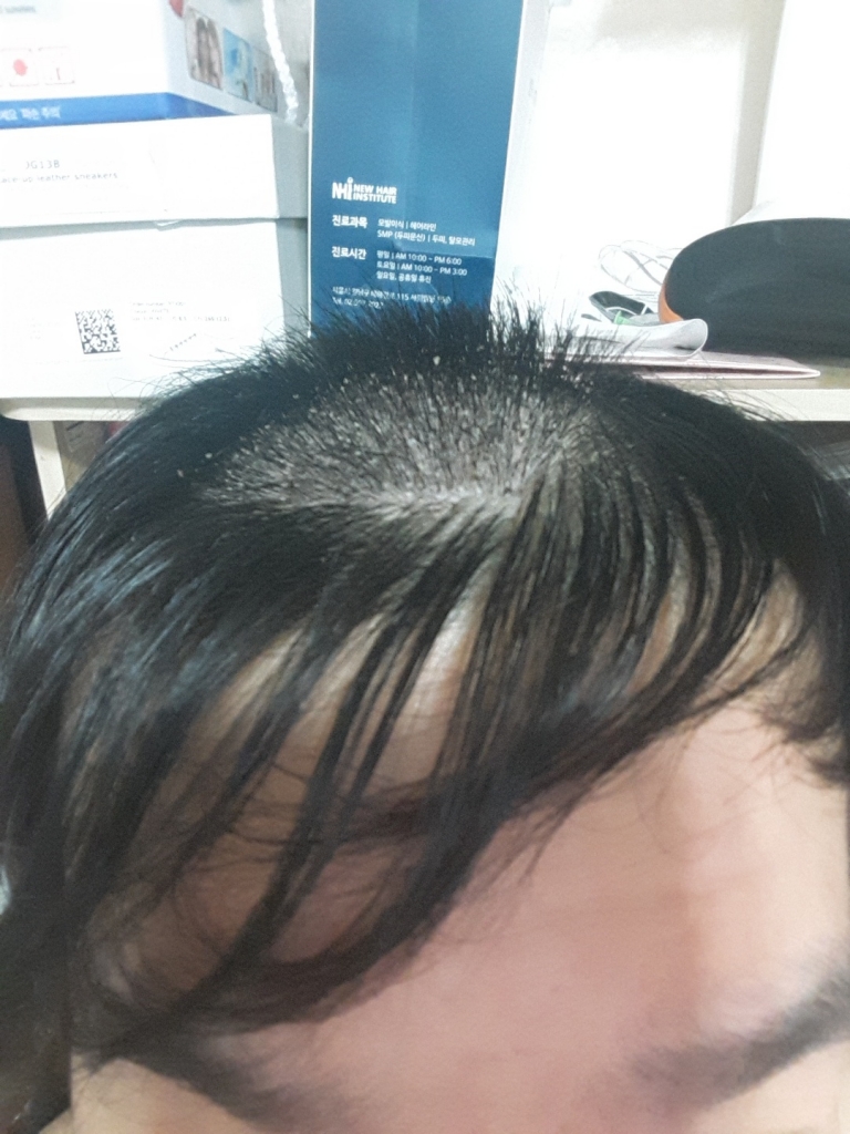 KakaoTalk_20170803_065123794.jpg