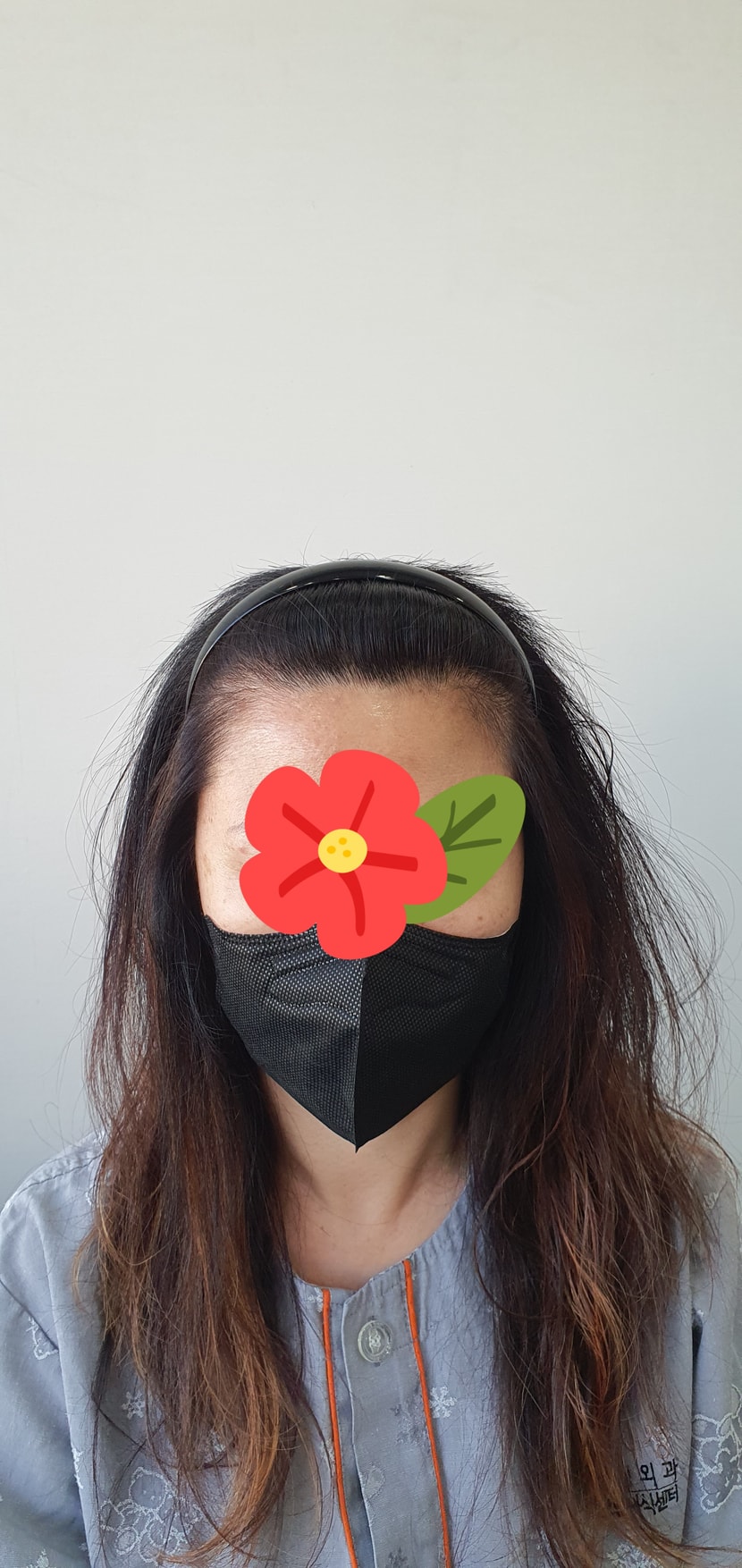 수술전