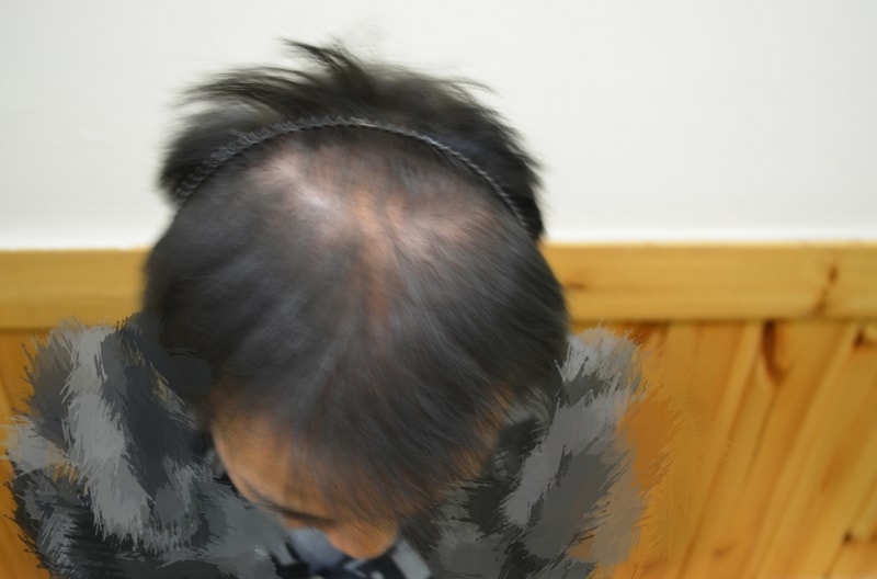 크기변환_크기변환_1.jpg