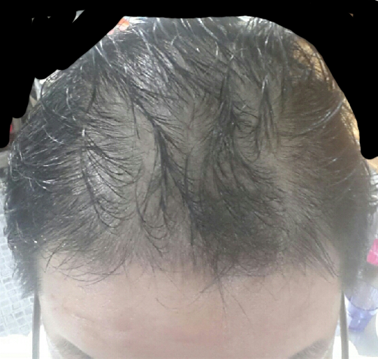 image_04-1.png