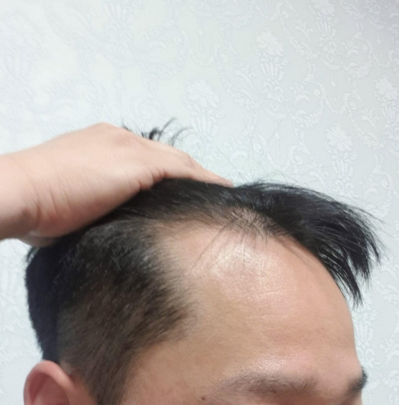 앙드레침묵_이마반 재활용.jpg