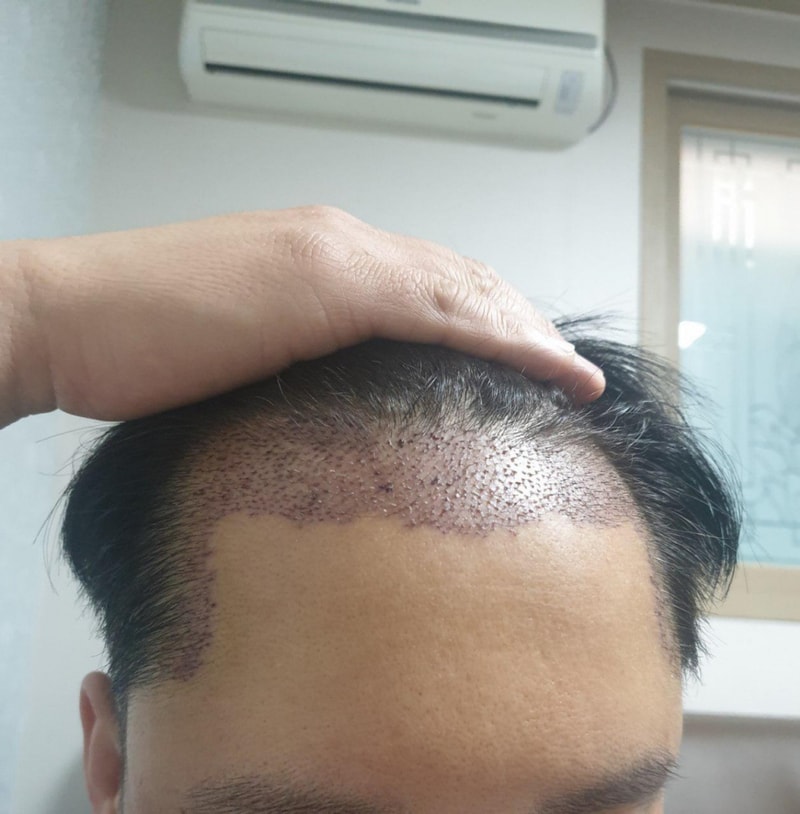 앙드레침묵_이마반 재활용 (4).jpg