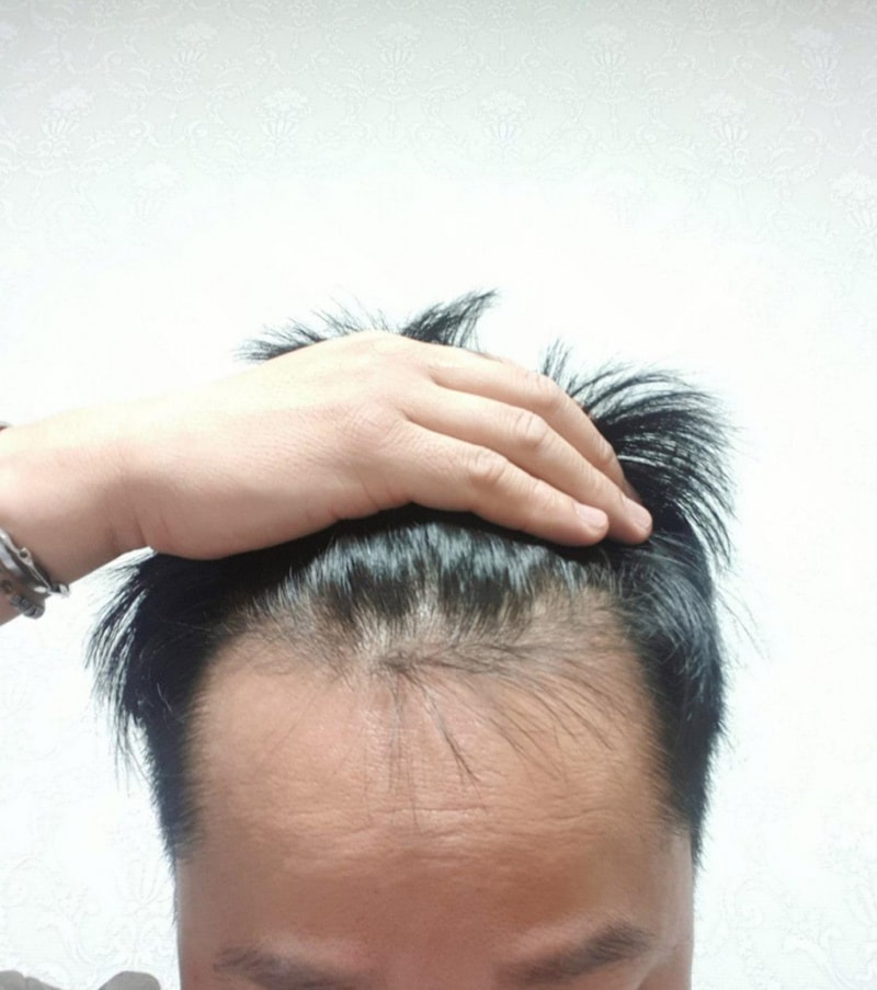 앙드레침묵_이마반 재활용 (2).jpg