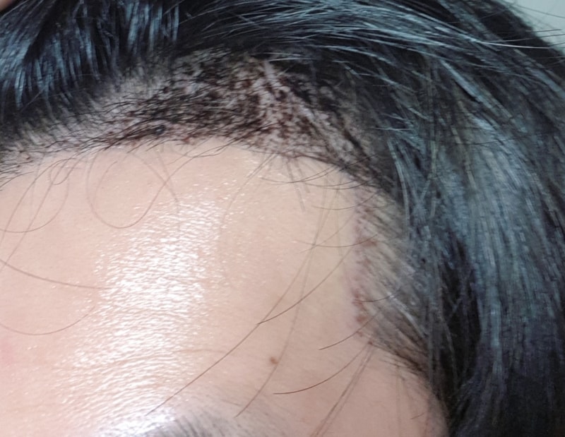 20180318_214209.jpg