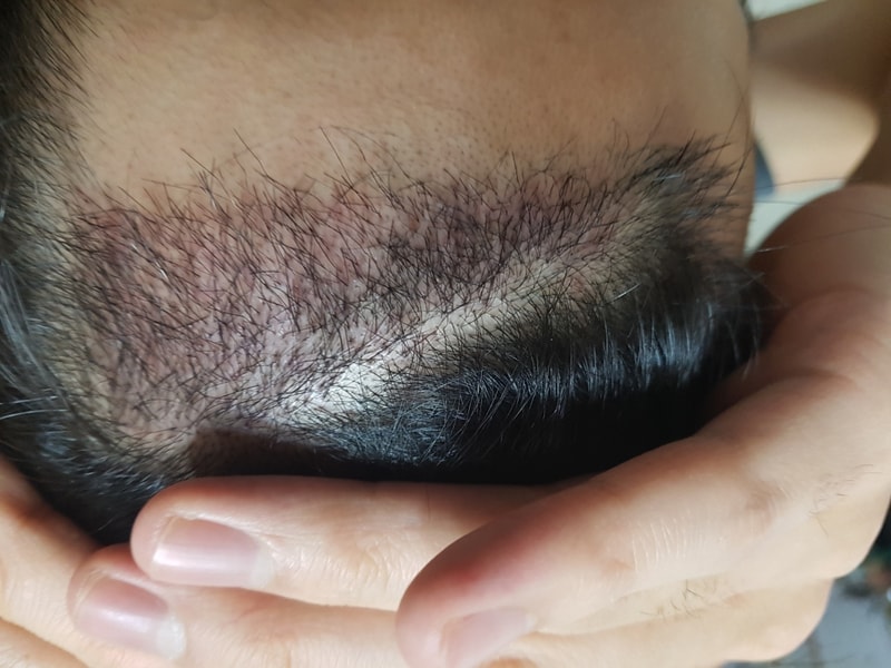 20180307_204624.jpg