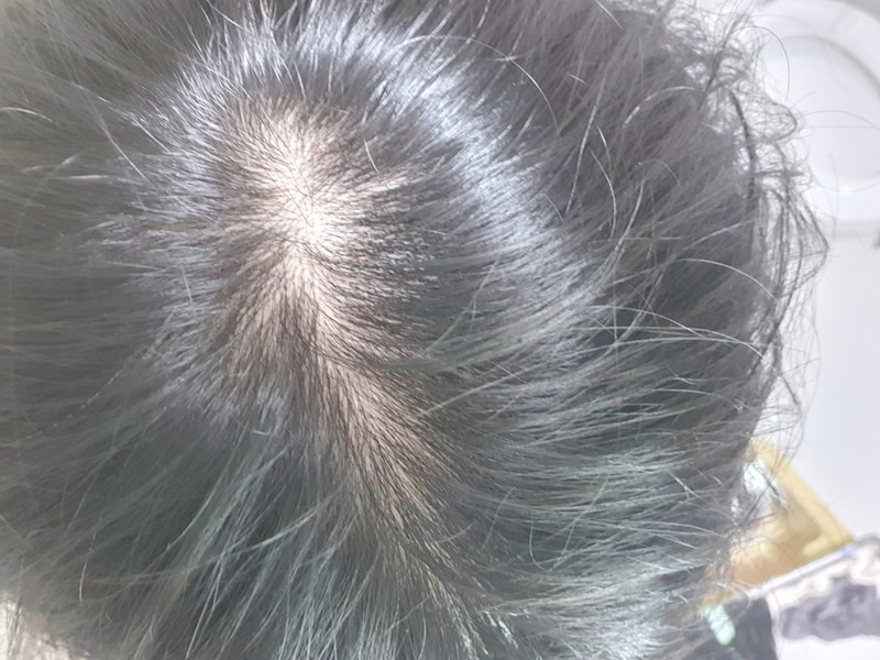 20210307_100904.jpg
