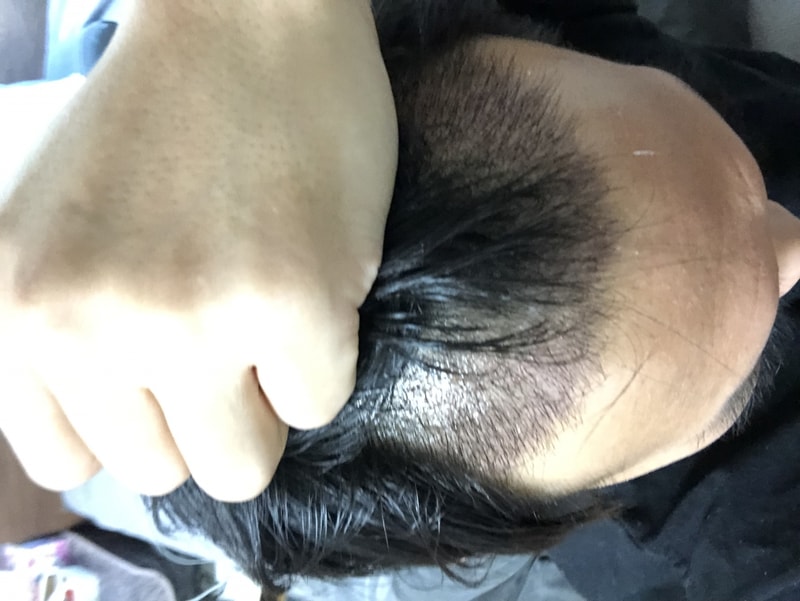 357FC30E-2D5F-4CC9-B146-53155EF41625.jpeg