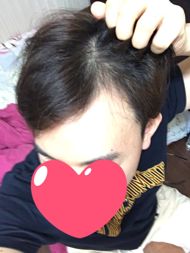 KakaoTalk_20170703_213353279.jpg