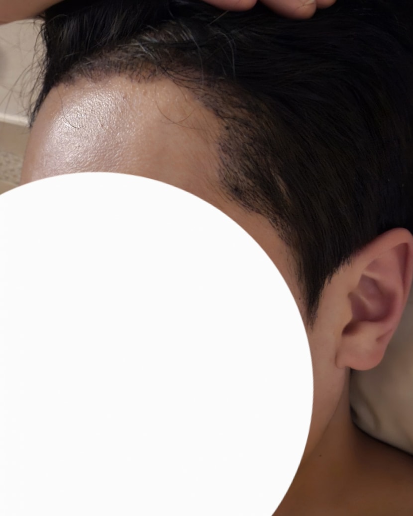 3일차 측면샷