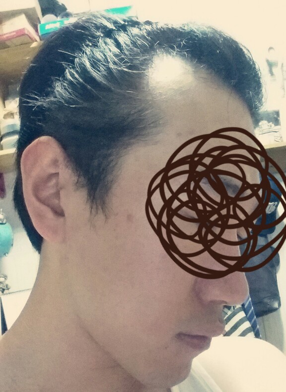 before.jpg