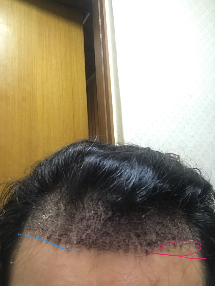 정면.jpg