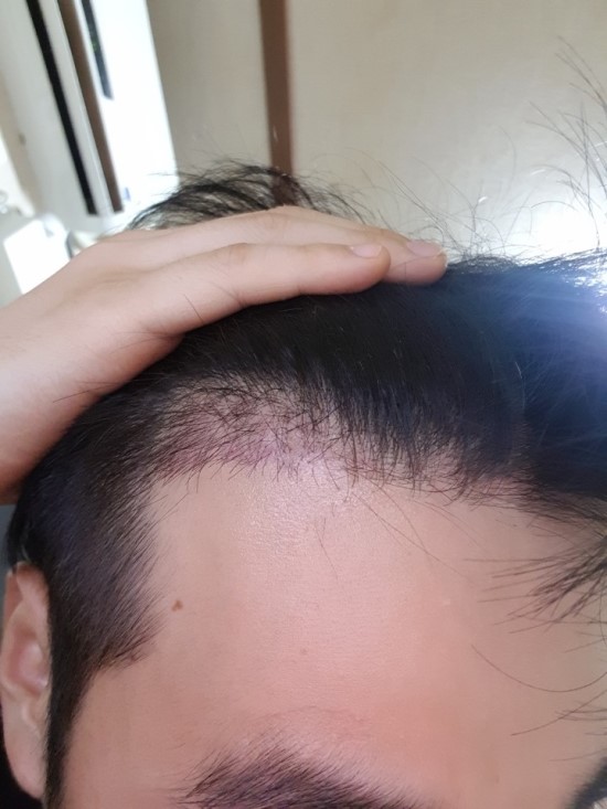 KakaoTalk_20170720_145830515.jpg