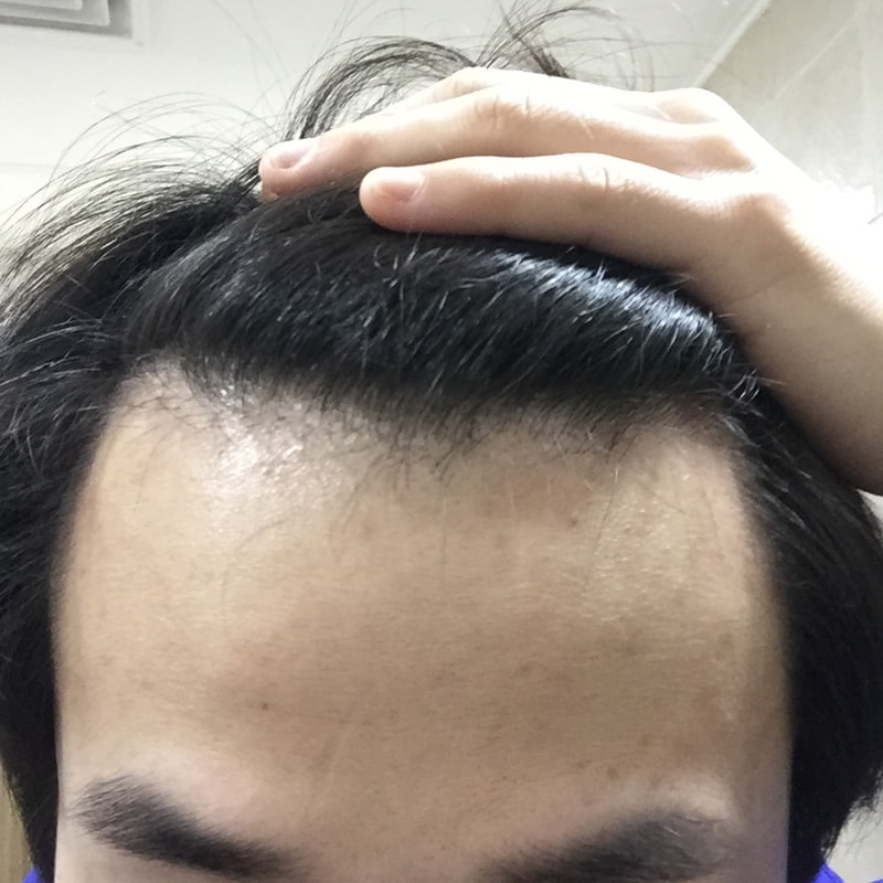image.jpg