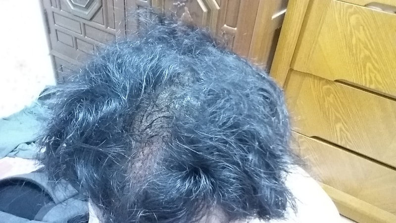 20170727_172322.jpg