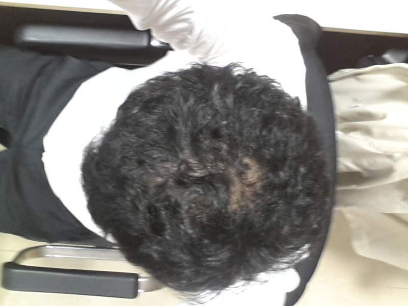정수리2 20140204.jpg