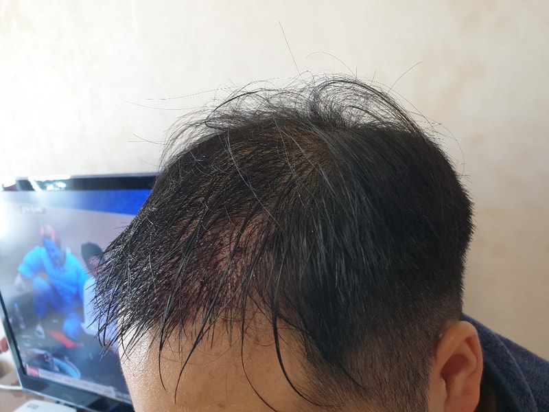 샴푸후.jpg