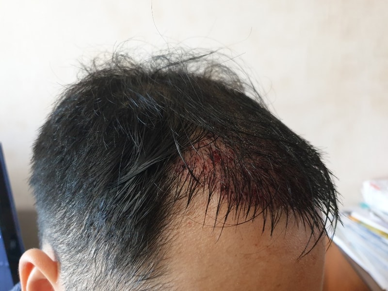 샴푸후 2.jpg