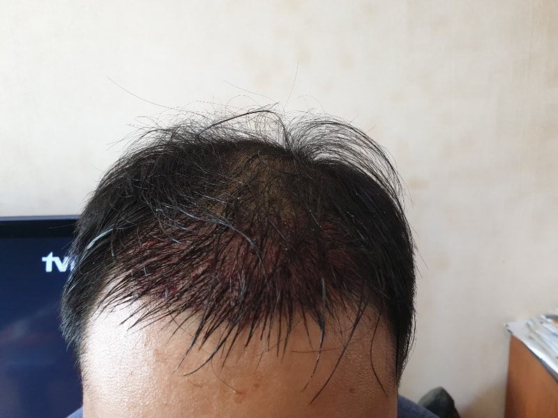 샴푸후 3.jpg